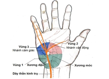 Bài giảng-Hội chứng ống thần kinh trụ