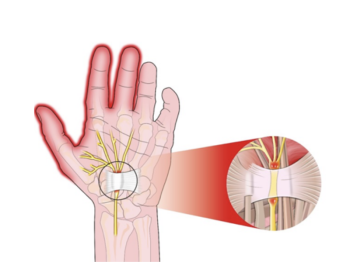 Bài giảng-Siêu âm chẩn đoán hội chứng giao thoa